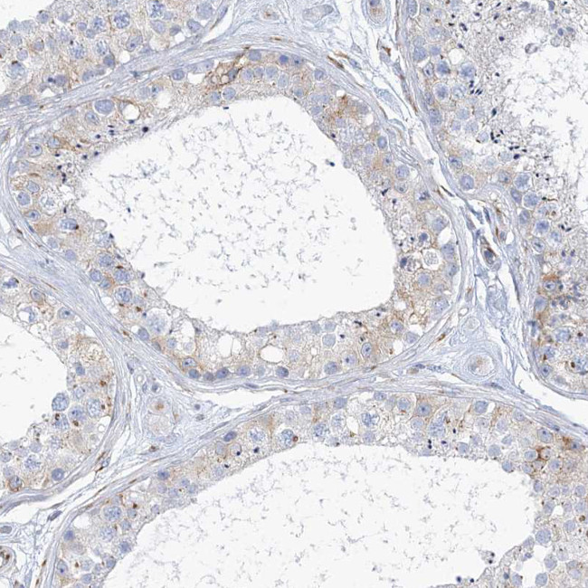 PLEKHG4B Antibody in Immunohistochemistry (Paraffin) (IHC (P))