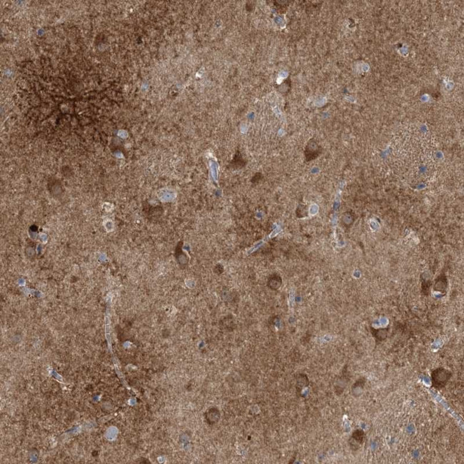 CaBP8 Antibody in Immunohistochemistry (Paraffin) (IHC (P))