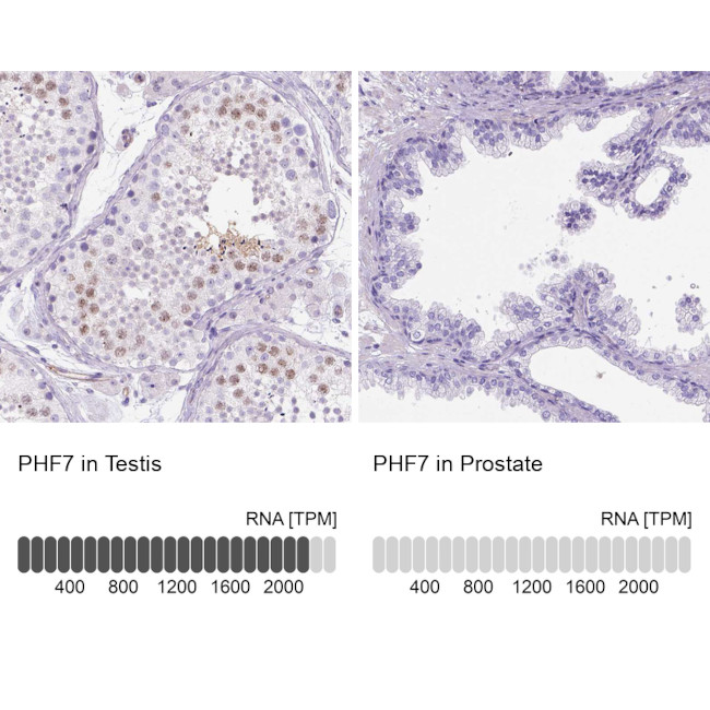 PHF7 Antibody in Immunohistochemistry (IHC)