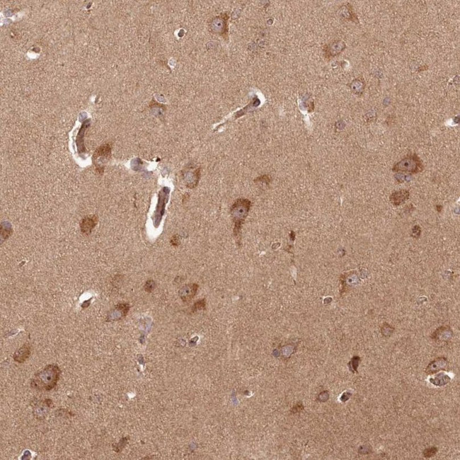 ARL3 Antibody in Immunohistochemistry (IHC)