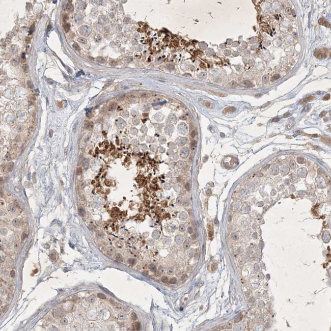 FAM44B Antibody in Immunohistochemistry (Paraffin) (IHC (P))