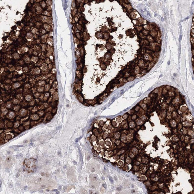 VSIG1 Antibody in Immunohistochemistry (Paraffin) (IHC (P))