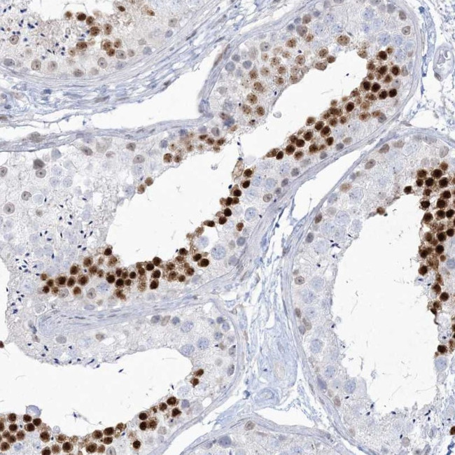 HOMEZ Antibody in Immunohistochemistry (Paraffin) (IHC (P))