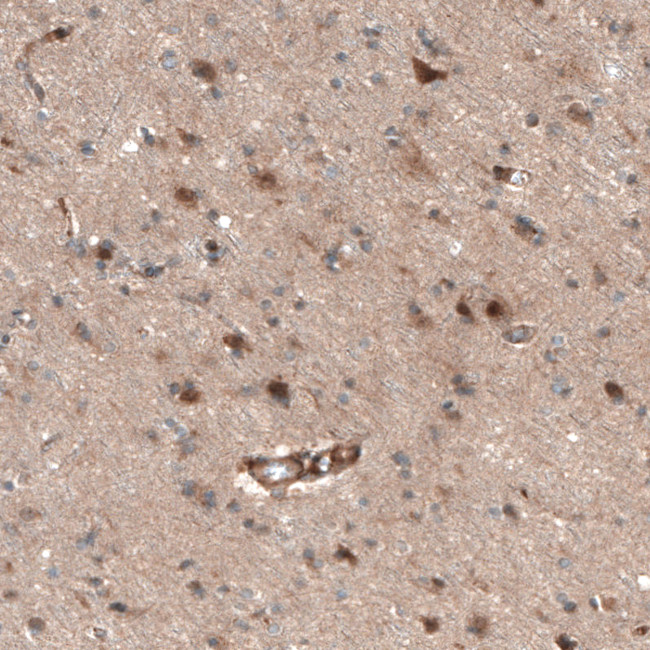 CAMTA1 Antibody in Immunohistochemistry (Paraffin) (IHC (P))