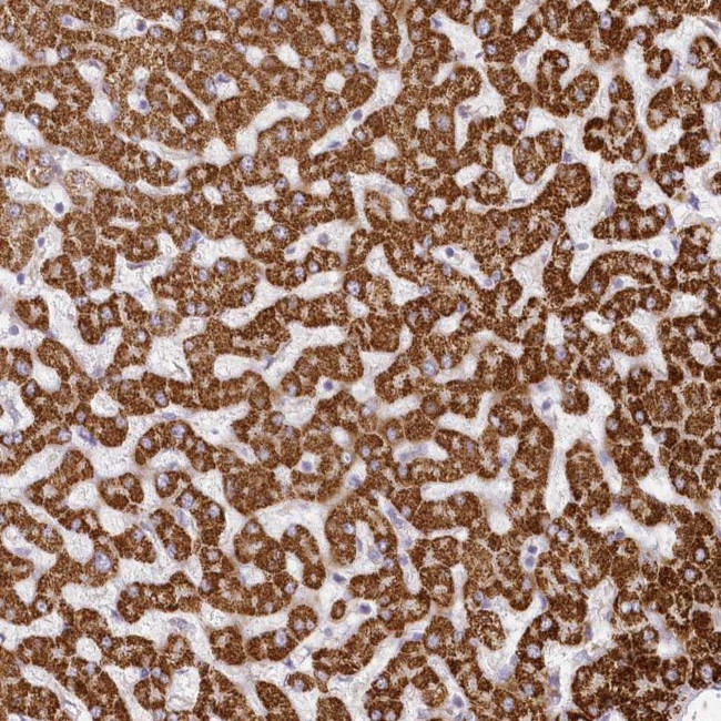 CCDC30 Antibody in Immunohistochemistry (Paraffin) (IHC (P))