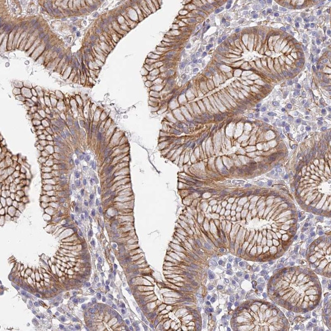 CCDC30 Antibody in Immunohistochemistry (Paraffin) (IHC (P))