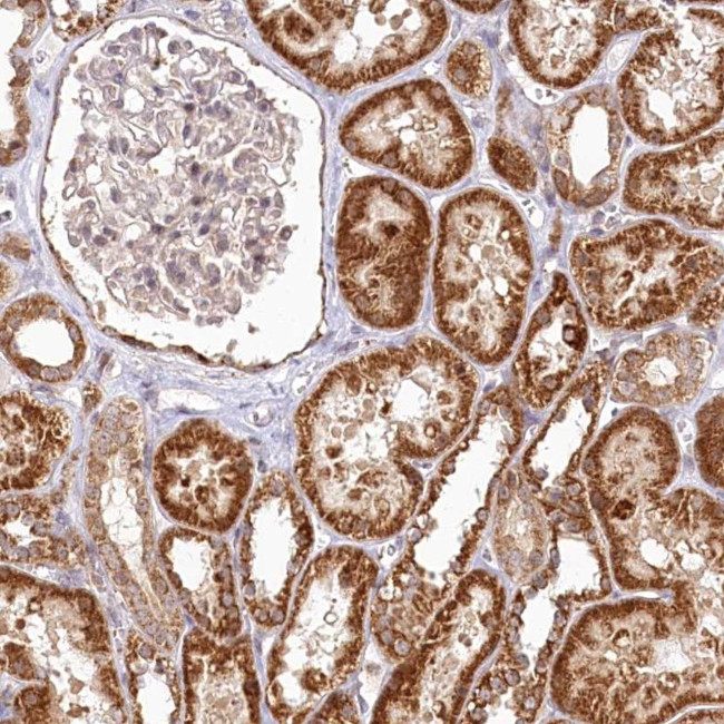 RTN4IP1 Antibody in Immunohistochemistry (Paraffin) (IHC (P))