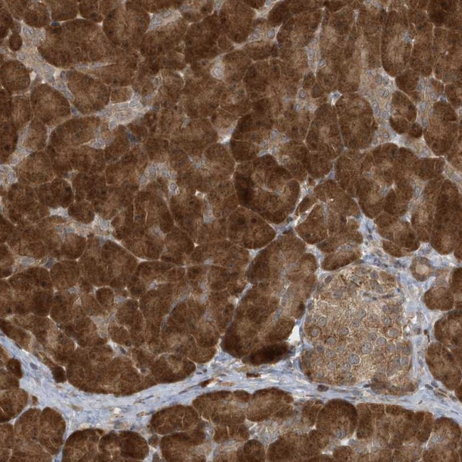 ATG4A Antibody in Immunohistochemistry (Paraffin) (IHC (P))