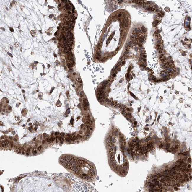 ARHGAP31 Antibody in Immunohistochemistry (Paraffin) (IHC (P))
