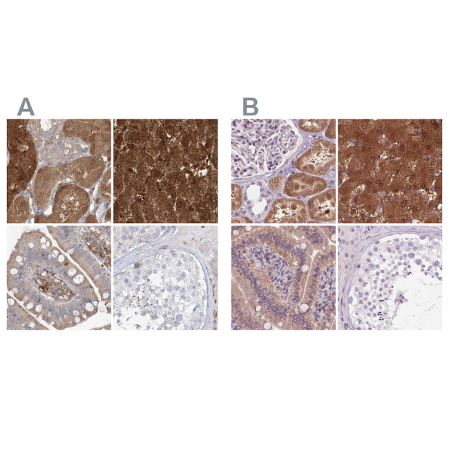 HAAO Antibody in Immunohistochemistry (IHC)