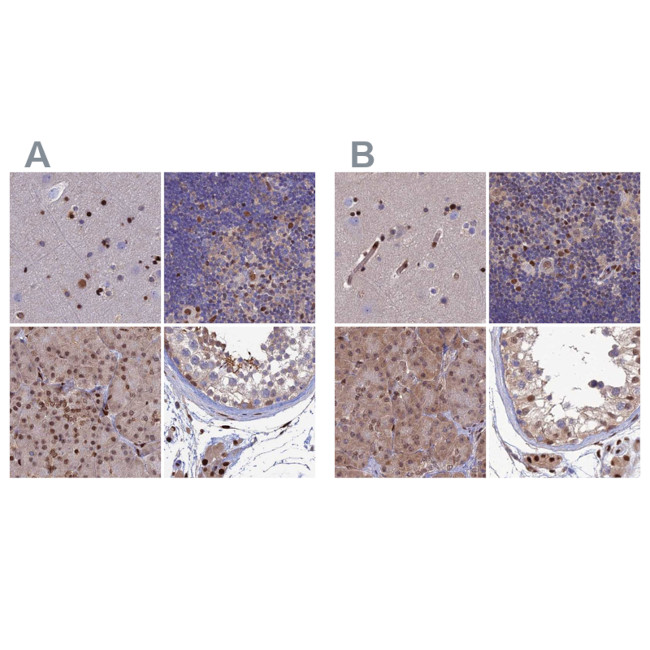 DNPEP Antibody in Immunohistochemistry (IHC)