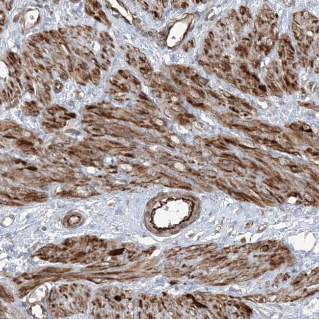 FBXL17 Antibody in Immunohistochemistry (Paraffin) (IHC (P))