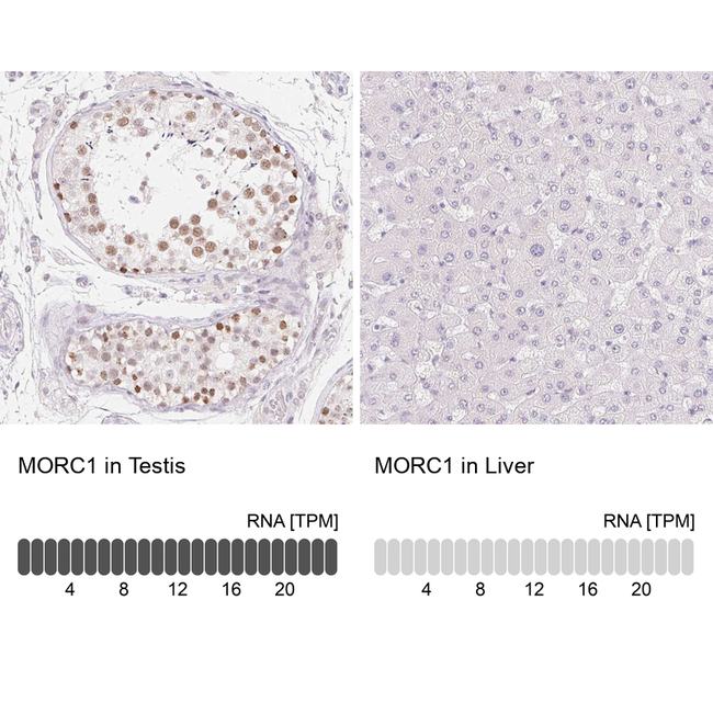 MORC1 Antibody in Immunohistochemistry (Paraffin) (IHC (P))