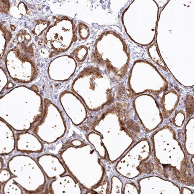 SNED1 Antibody in Immunohistochemistry (Paraffin) (IHC (P))