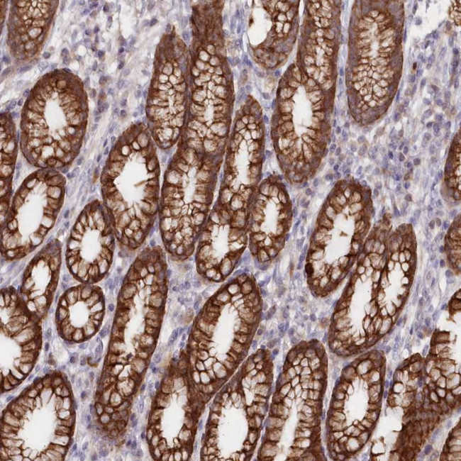 SNED1 Antibody in Immunohistochemistry (Paraffin) (IHC (P))