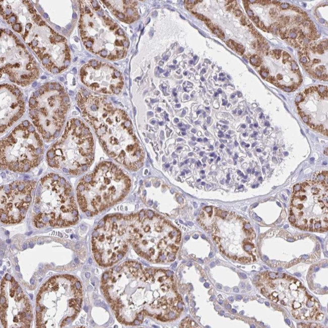 DMGDH Antibody in Immunohistochemistry (Paraffin) (IHC (P))