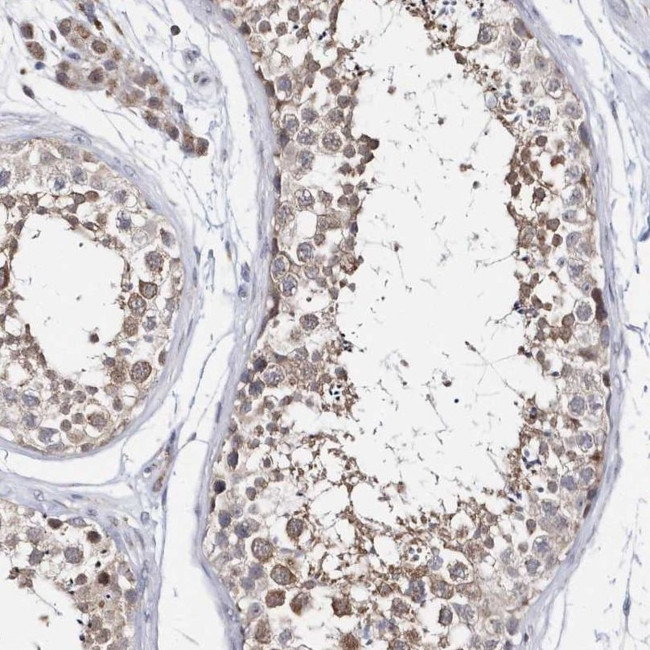 SPAT5 Antibody in Immunohistochemistry (IHC)