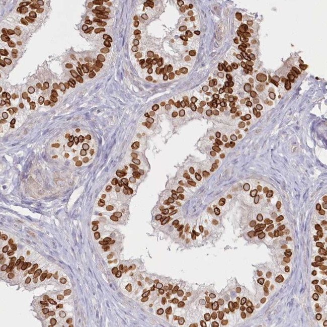 SPINK13 Antibody in Immunohistochemistry (Paraffin) (IHC (P))