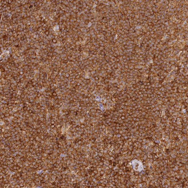 DOCK2 Antibody in Immunohistochemistry (Paraffin) (IHC (P))