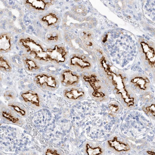 Ribulose-phosphate 3-epimerase Antibody in Immunohistochemistry (Paraffin) (IHC (P))