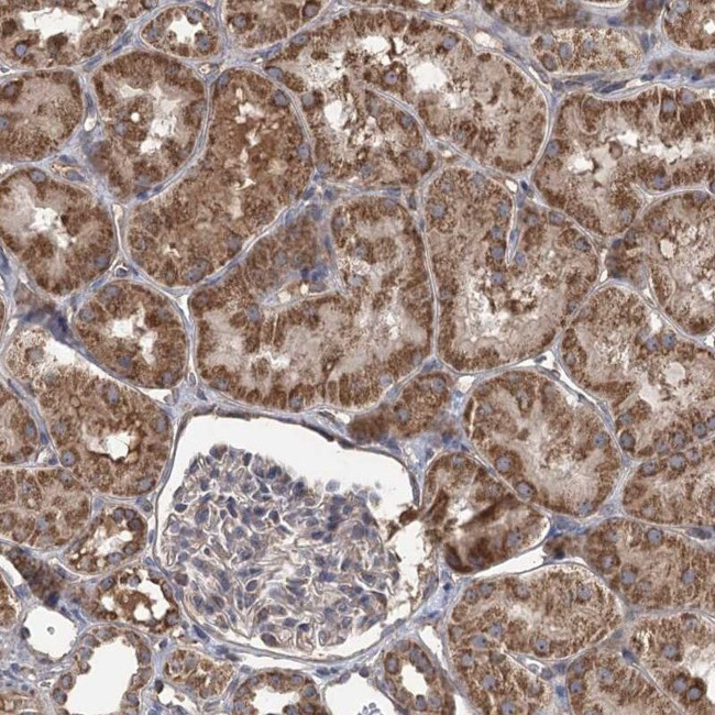 RWDD4 Antibody in Immunohistochemistry (IHC)