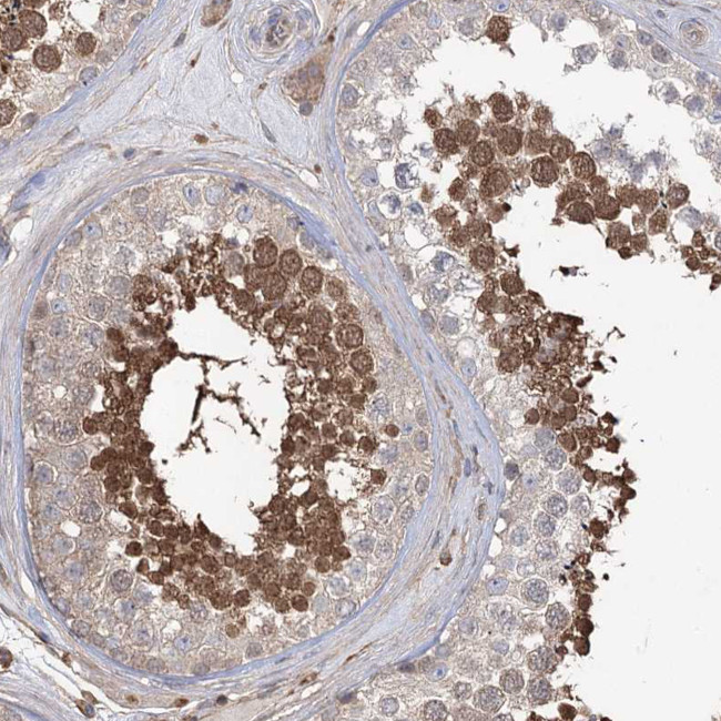 FAM13B Antibody in Immunohistochemistry (Paraffin) (IHC (P))