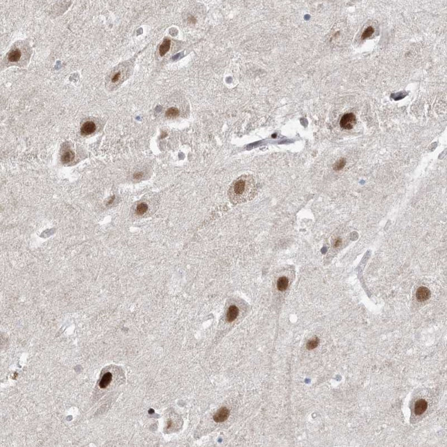 WAC Antibody in Immunohistochemistry (Paraffin) (IHC (P))
