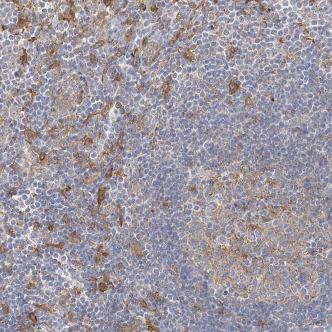 CCNJ Antibody in Immunohistochemistry (IHC)