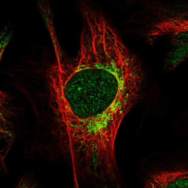 HIBCH Antibody in Immunocytochemistry (ICC/IF)