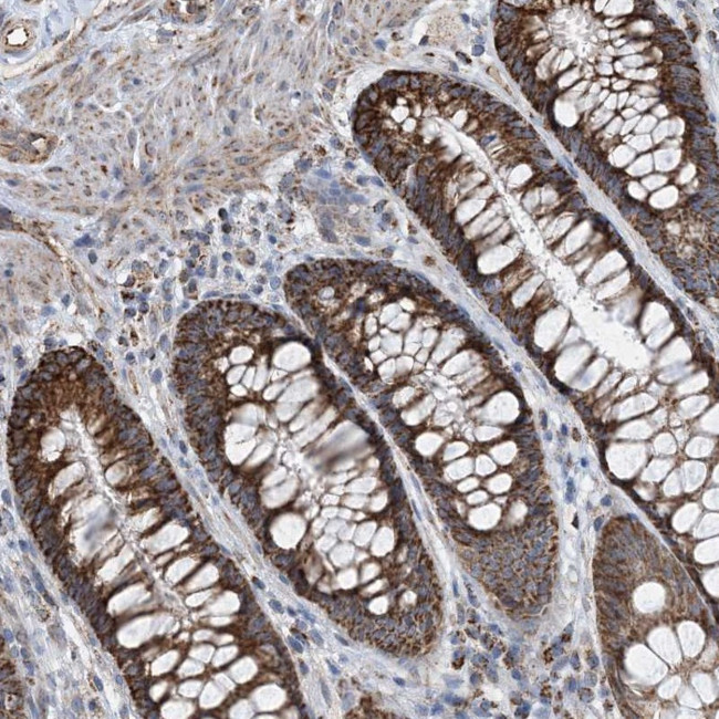 PCDHGA1 Antibody in Immunohistochemistry (Paraffin) (IHC (P))