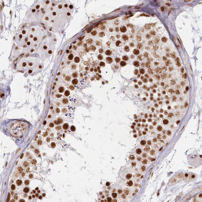 DDX46 Antibody in Immunohistochemistry (Paraffin) (IHC (P))