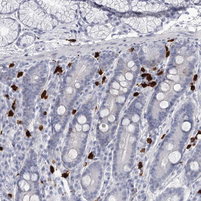 CCDC147 Antibody in Immunohistochemistry (Paraffin) (IHC (P))
