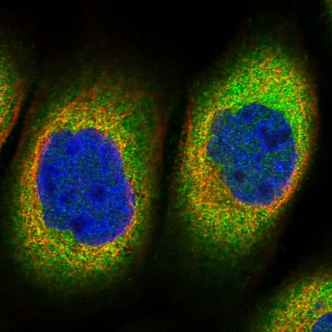 TTC1 Antibody in Immunocytochemistry (ICC/IF)