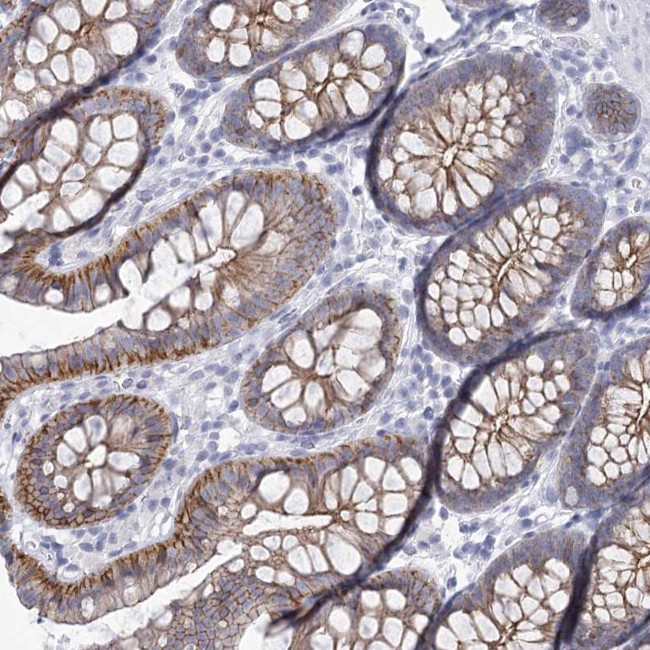WNT8B Antibody in Immunohistochemistry (Paraffin) (IHC (P))