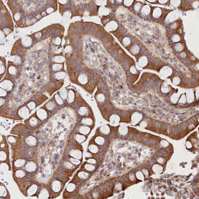 COMMD3 Antibody in Immunohistochemistry (Paraffin) (IHC (P))
