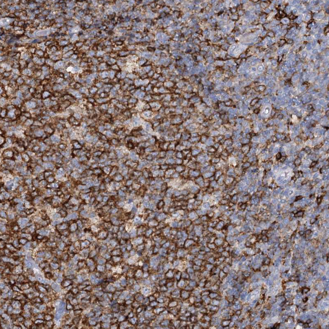 PIWIL4 Antibody in Immunohistochemistry (Paraffin) (IHC (P))