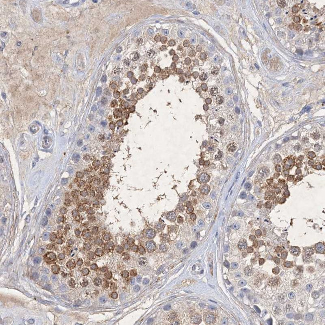 C11orf58 Antibody in Immunohistochemistry (Paraffin) (IHC (P))