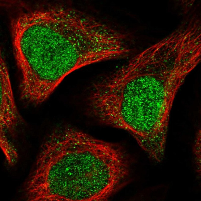 APC15 Antibody in Immunocytochemistry (ICC/IF)