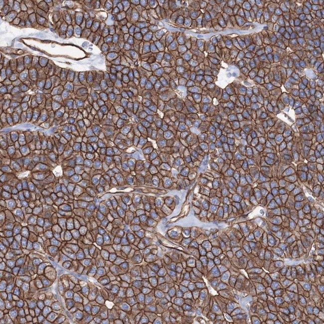 ANKRD37 Antibody in Immunohistochemistry (Paraffin) (IHC (P))