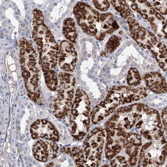 CHDH Antibody in Immunohistochemistry (Paraffin) (IHC (P))