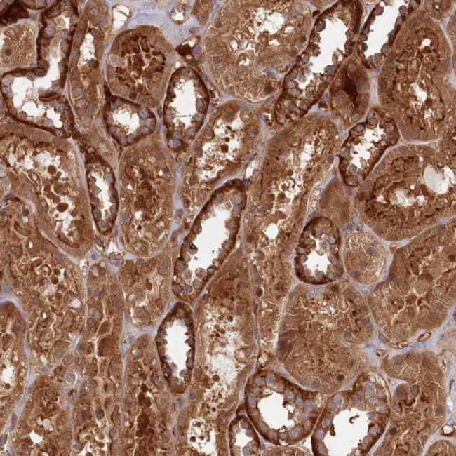 ABHEB Antibody in Immunohistochemistry (Paraffin) (IHC (P))