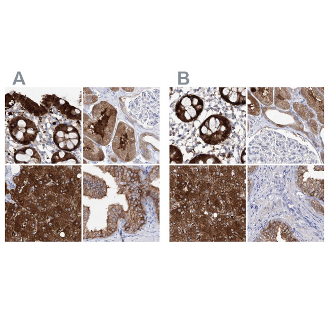 UGDH Antibody in Immunohistochemistry (IHC)