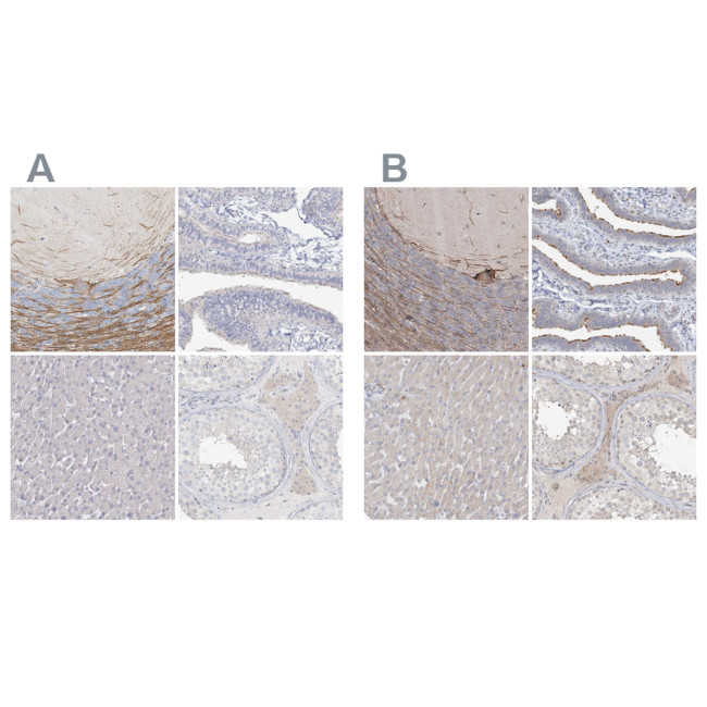 LRP2BP Antibody in Immunohistochemistry (IHC)