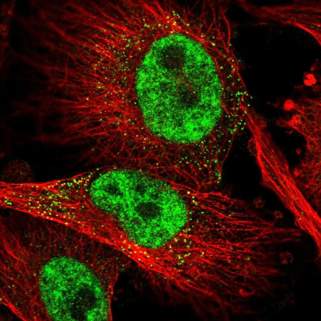 SLC4A1AP Antibody in Immunocytochemistry (ICC/IF)