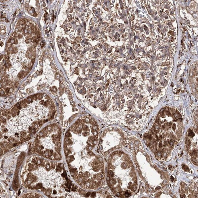 FANCL Antibody in Immunohistochemistry (IHC)