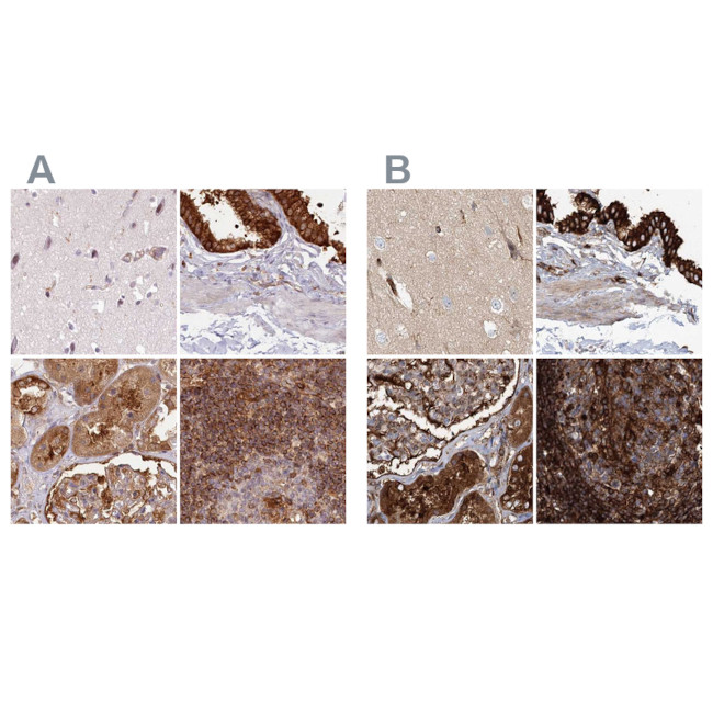 EML4 Antibody in Immunohistochemistry (IHC)
