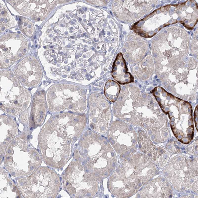 LZK Antibody in Immunohistochemistry (Paraffin) (IHC (P))