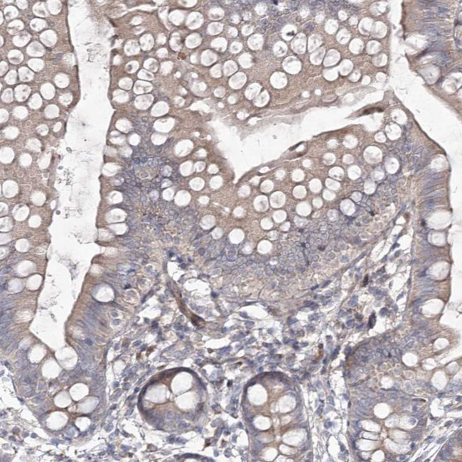 KIP2 Antibody in Immunohistochemistry (Paraffin) (IHC (P))