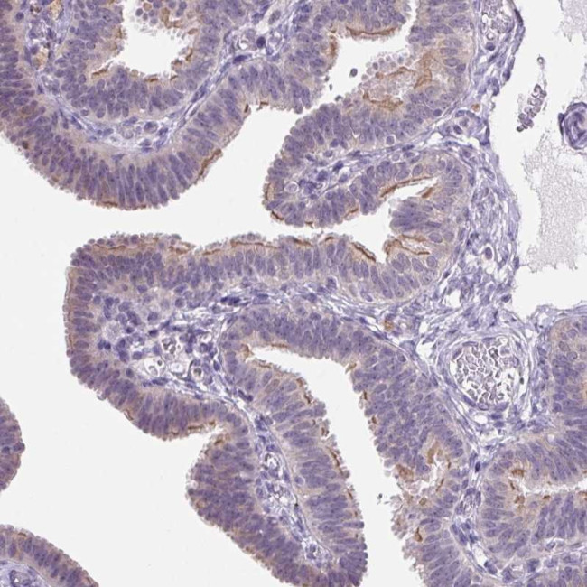 VWA3B Antibody in Immunohistochemistry (Paraffin) (IHC (P))