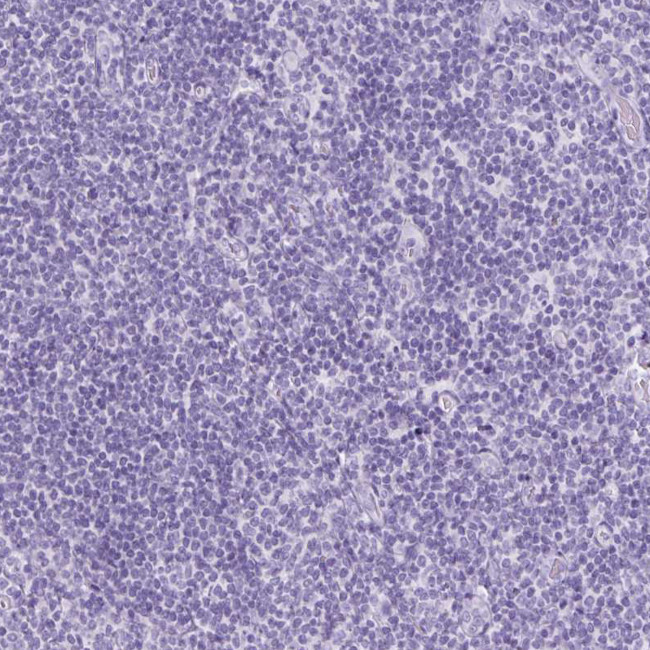 TFF2 Antibody in Immunohistochemistry (Paraffin) (IHC (P))